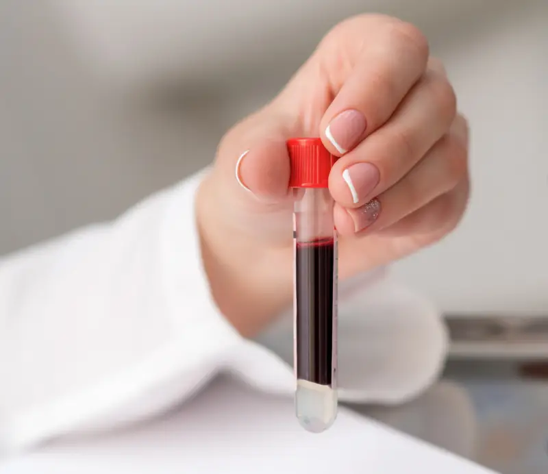 A hand holding a vial of blood